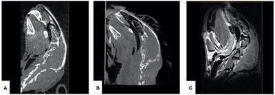 3D Printed Biomimetic Rabbit Airway Simulation Model for Nasotracheal Intubation Training